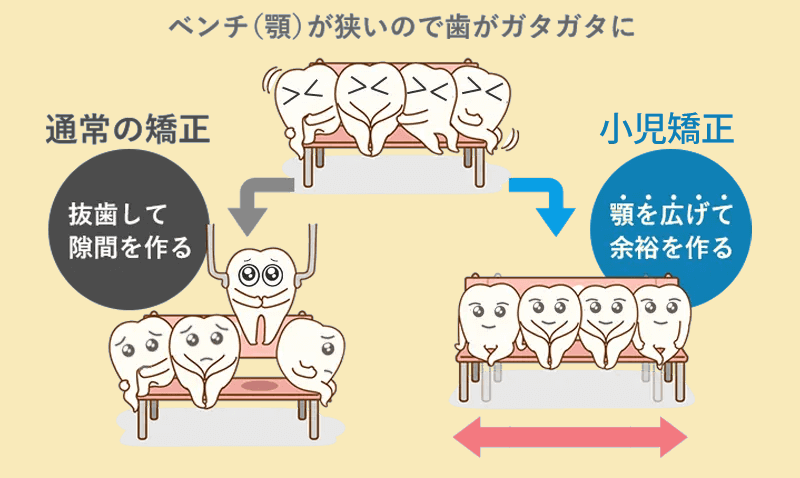 顎の成長を利用した骨格的な矯正