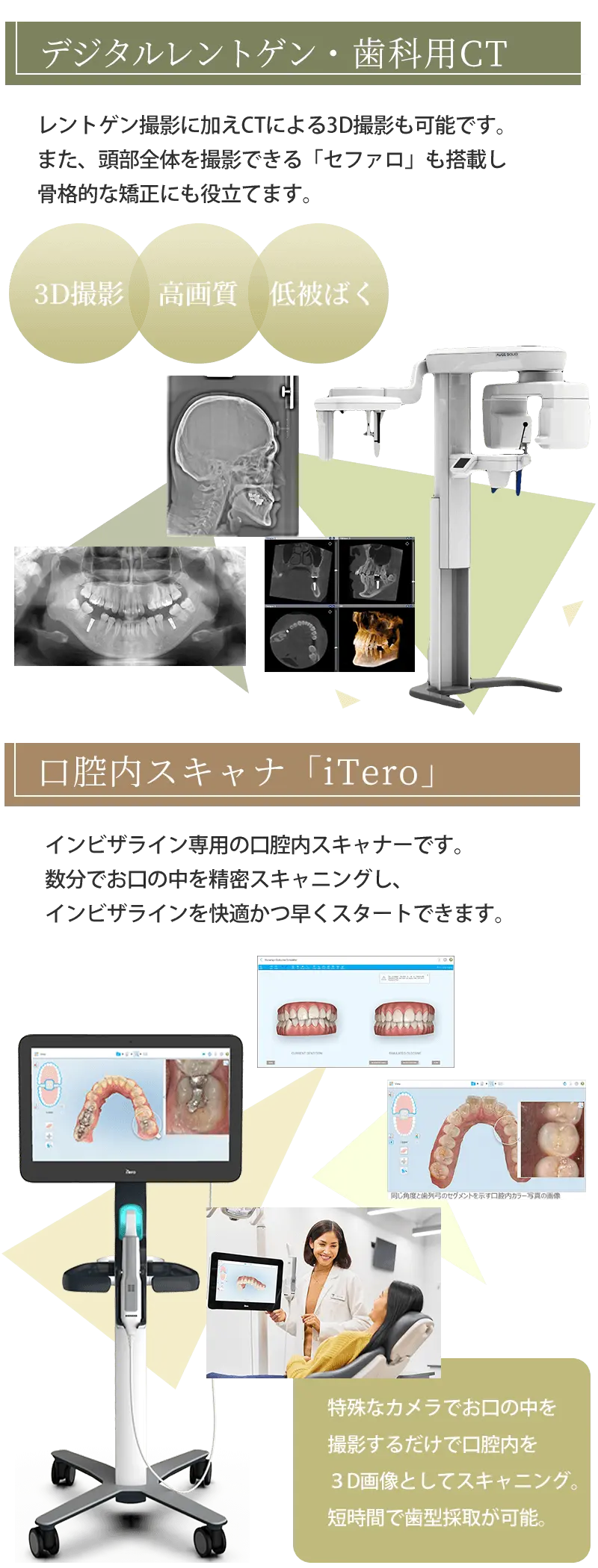 CT iTero