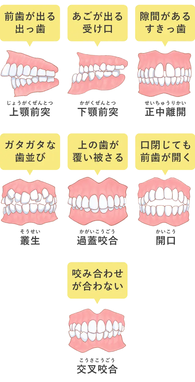 矯正歯科