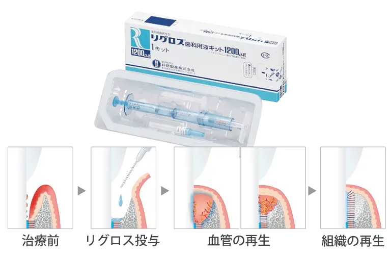 リグロス